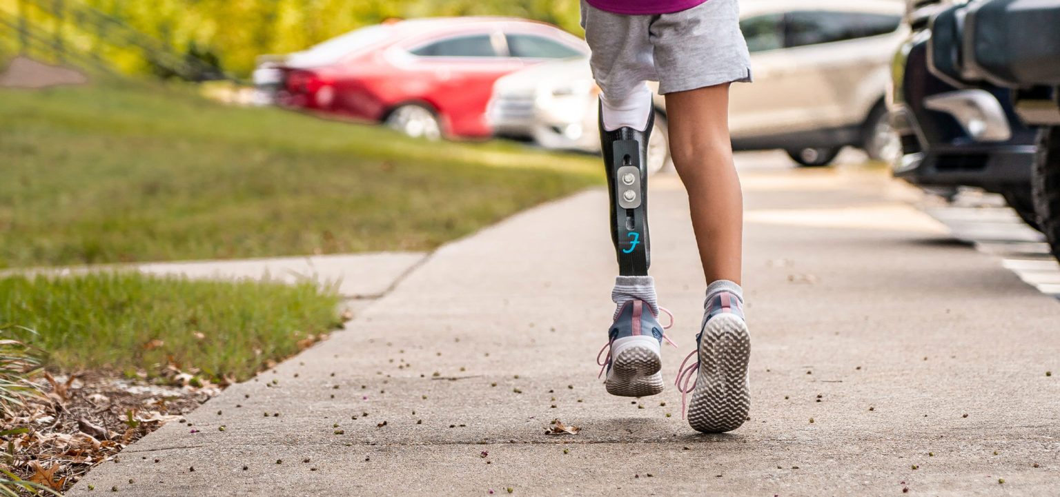 paediatric prosthetics hero 1536x721